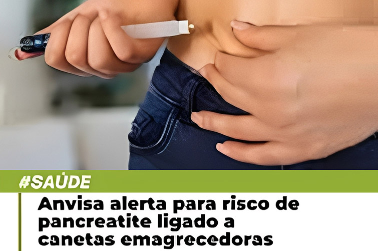 ANVISA ALERTA PARA RISCO DE PANCREATITE LIGADO A CANETAS EMAGRECEDORAS